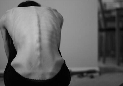 ana-anorexia-anorexic-bones-Favim.com-1297964